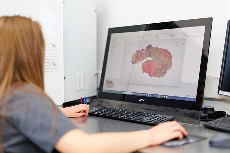 3d scans en technieken bij dental esthetics hengelo